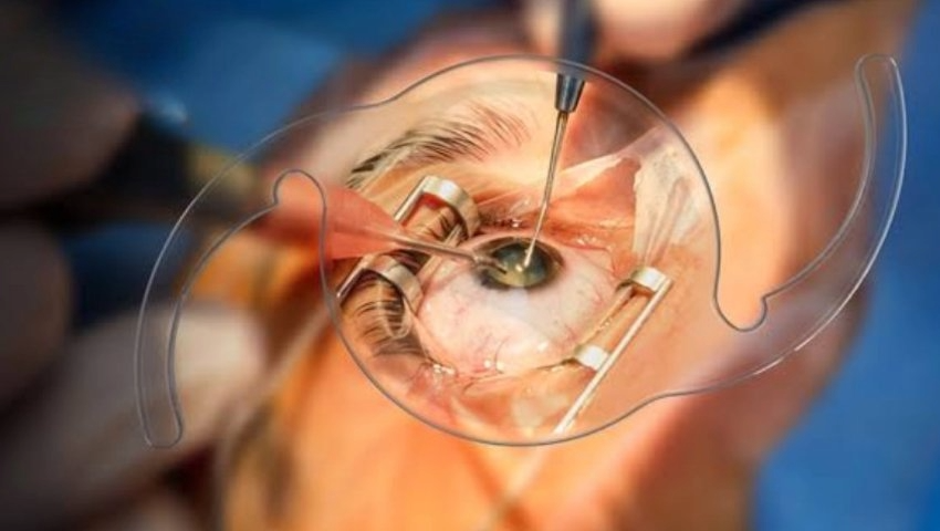 Comprehensive Eye Exams