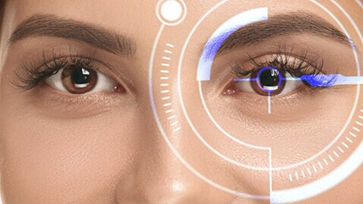 Laser Vision Correction