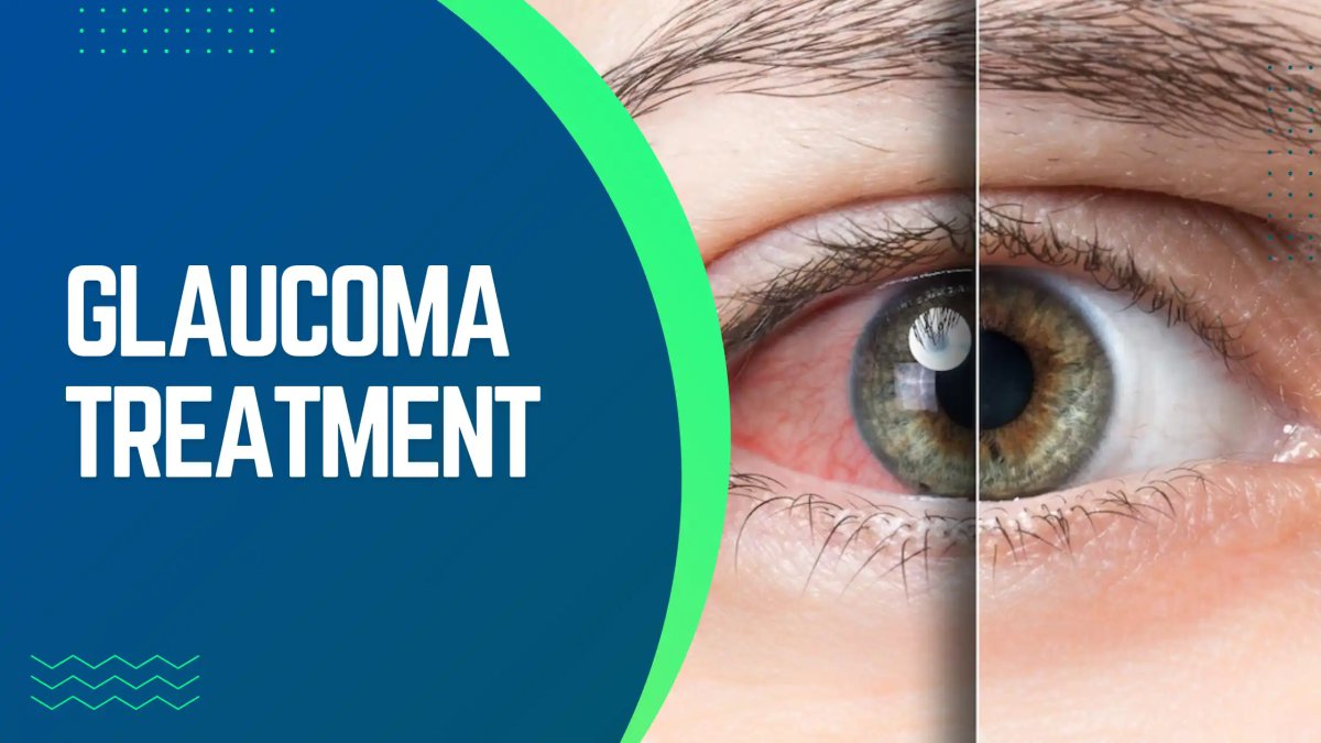 Glaucoma Management