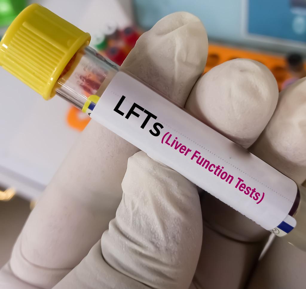 LIVER CARE