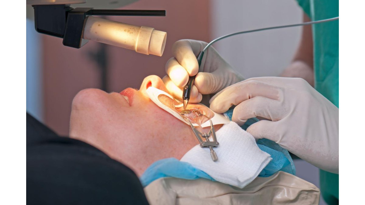 LASIK SURGERY
